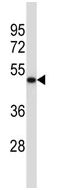 Anti-Synaptotagmin V antibody (ab116452) at 1/100 dilution + K562 cell line lysates at 35 µg