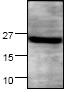 Anti-Syndecan 4 antibody (ab24511) + Jurkat Cell lysate
