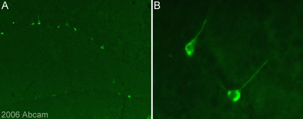 Immuofluorescent staining for SynGap phospho S1123 in the hippocampus of a naïve rat using antibody ab16649. [A] Immunostaining was observed in the cytoplasm of a few hippocampal neurons (Picture taken with a X10 objective). Higher power magnification of the same hippocampal section is shown in image B (X 40 objective). Tissue preparation: rat brain tissue was perfusion fixed (4% PFA) followed by post fix and cryoprotection in 20% sucrose before freezing in OCT. 30µm coronal sections were cut on a cryostat for free floating IHC. Primary antibody ab16649 was used at 1/3000 (0.2µg/ml) incubated overnight at room temperature. Secondary antibody used: anti-rabbit Alexa fluor 488 (1/1000) incubated for 2 hours at room temperature.