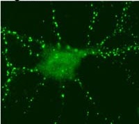 Immunolocalization of SynGAP in rat hippocampal neurons using ab3344.