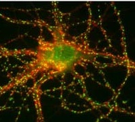 Immunolocalization of SynGAP in rat hippocampal neurons using ab3344.