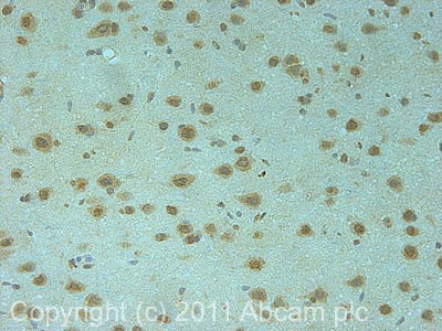 IHC image of ab6179 staining in rat normal brain formalin fixed paraffin embedded tissue section, performed on a Leica BondTM system using the standard protocol F. The section was pre-treated using heat mediated antigen retrieval with sodium citrate buffer (pH6, epitope retrieval solution 1) for 20 mins. The section was then incubated with ab6179, 5µg/ml, for 15 mins at room temperature and detected using an HRP conjugated compact polymer system. DAB was used as the chromogen. The section was then counterstained with haematoxylin and mounted with DPX.For other IHC staining systems (automated and non-automated) customers should optimize variable parameters such as antigen retrieval conditions, primary antibody concentration and antibody incubation times.