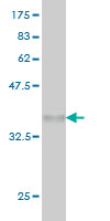 Western blot against tagged recombinant protein immunogen using ab56627 Synphilin 1 antibody at 1ug/ml.