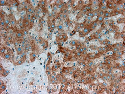 IHC image of SLC22A1 staining in Human normal liver formalin fixed paraffin embedded tissue section, performed on a Leica BondTM system using the standard protocol F. The section was pre-treated using heat mediated antigen retrieval with sodium citrate buffer (pH6, epitope retrieval solution 1) for 20 mins. The section was then incubated with ab118539, 5µg/ml, for 15 mins at room temperature and detected using an HRP conjugated compact polymer system. DAB was used as the chromogen. The section was then counterstained with haematoxylin and mounted with DPX.For other IHC staining systems (automated and non-automated) customers should optimize variable parameters such as antigen retrieval conditions, primary antibody concentration and antibody incubation times.