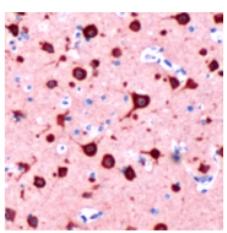 ab73913, at a 1/100 dilution, staining Syntaxin 1a in formalin fixed, paraffin embedded human brain tissue by Immunohistochemistry.