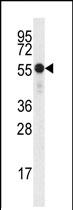 Anti-SYVN1 antibody (ab75709) at 1/50 dilution + Hela cell line lysate at 35 µg