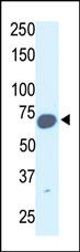 Anti-SYVN1 antibody - Carboxyterminal end (ab38456) at 1/100 dilution + mouse kidney tissue lysate