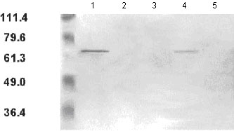 All lanes : Anti-T Plastin antibody (ab45769) at 1/1000 dilutionLane 1 : Bacterial extract expressing T-Plastin at 1 µgLane 2 : Bacterial extract expressing L-Plastin at 1 µgLane 3 : Bacterial extract expressing I-Plastin at 1 µgLane 4 : Sezary cell extract at 10 µgLane 5 : Control T-Helper cells at 10 µg