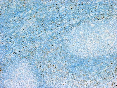 IHC image of T-bet / Tbx21 staining in Human normal tonsil formalin fixed paraffin embedded tissue section, performed on a Leica BondTM system using the standard protocol F. The section was pre-treated using heat mediated antigen retrieval with sodium citrate buffer (pH6, epitope retrieval solution 1) for 20 mins. The section was then incubated with ab91109, 5µg/ml, for 15 mins at room temperature and detected using an HRP conjugated compact polymer system. DAB was used as the chromogen. The section was then counterstained with haematoxylin and mounted with DPX.For other IHC staining systems (automated and non-automated) customers should optimize variable parameters such as antigen retrieval conditions, primary antibody concentration and antibody incubation times.
