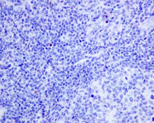 Immunohistochemical analysis of paraffin embedded normal Human tonsil tissue using ab150440 showing -ve staining.