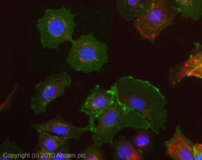 ICC/IF image of ab79976 stained MCF7 cells. The cells were 4% PFA fixed (10 min) and then incubated in 1%BSA / 10% normal goat serum / 0.3M glycine in 0.1% PBS-Tween for 1h to permeabilise the cells and block non-specific protein-protein interactions. The cells were then incubated with the antibody (ab79976, 5µg/ml) overnight at +4°C. The secondary antibody (green) was Alexa Fluor® 488 goat anti-mouse IgG (H+L) used at a 1/1000 dilution for 1h. Alexa Fluor® 594 WGA was used to label plasma membranes (red) at a 1/200 dilution for 1h. DAPI was used to stain the cell nuclei (blue) at a concentration of 1.43µM.