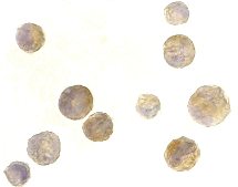 ab5994 staining TACI in K562 cells with TACI antibody at 2 µg/ml by ICC/IF.