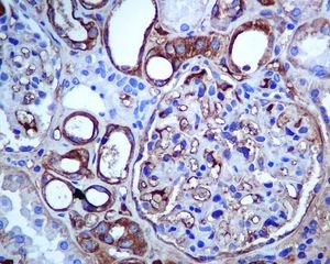 ab124826, at 1/100 dilution, staining SLC22A3 in paraffin-embedded Human kidney tissue by Immunohistochemistry.