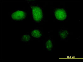 Immunofluorescent analysis of HeLa cells labeling TAF7 with ab167620 at 10 µg/ml. Antibody purification with Protein A will be needed prior to use.