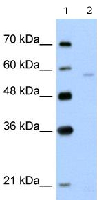All lanes : Anti-SLC22A7 antibody (ab58683) at 5 µg/mlLane 1 : Molecular weight markerLane 2 : Jurkat cell lysate at 10 µgSecondaryHRP conjugated anti-Rabbit IgG at 1/5000 dilutionObserved band size : 58 kDa (why is the actual band size different from the predicted?)Gel concentration: 12%