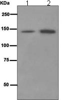 All lanes : Anti-TAG1 antibody [EPR5107] (ab109178) at 1/1000 dilutionLane 1 : Human cerebellum lysateLane 2 : Fetal brain lysateLysates/proteins at 10 µg per lane.