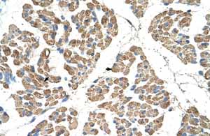 Immunohistochemistry (Formalin/PFA-fixed paraffin-embedded sections) analysis of human muscle tissue labelling SLC22A7 with ab58683 at 8µg/ml. Arrows indicate positive labelled skeletal muscle cells. Magnification: X400.