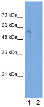 All lanes : Anti-SLC22A7 antibody (ab58683) at 2.5 µg/mlLane 1 : Jurkat cell lysateLane 2 : Jurkat cell lysate with blocking peptide at 2 µg/mlLysates/proteins at 25 µg per lane.