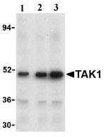 Lane 1 :  Anti-TAK1 antibody (ab25879) at 1 µg/mlLane 2 :  Anti-TAK1 antibody (ab25879) at 2 µg/mlLane 3 :  Anti-TAK1 antibody (ab25879) at 4 µg/mlLane 1 : Rat Thymus Tissue Lysate (ab4041)Lane 2 : Rat Thymus Tissue Lysate (ab4041)Lane 3 : Rat Thymus Tissue Lysate (ab4041)