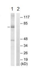 All lanes : Anti-TAK1 antibody (ab196955) at 1/500 dilutionLane 1 : Jurkat cell extract, treated with heat shockLane 2 : Jurkat cell extract, treated with heat shock with blocking peptide