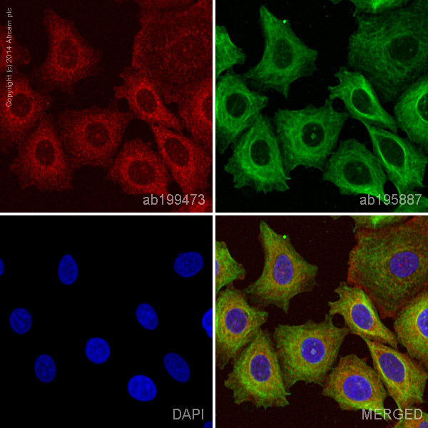ab199473 staining TAK1 in MCF7 cells. The cells were fixed with 100% methanol (5 min), permeabilized with 0.1% Triton X-100 for 5 minutes and then blocked with 1% BSA/10% normal goat serum/0.3M glycine in 0.1% PBS-Tween for 1h. The cells were then incubated overnight at +4°C with ab199473 at a 1/100 dilution (shown in red) and ab195887, Mouse monoclonal to alpha Tubulin (Alexa Fluor® 488), at a 1/250 dilution (shown in green). Nuclear DNA was labelled with DAPI (shown in blue).Image was taken with a confocal microscope (Leica-Microsystems, TCS SP8).This product also gave a positive signal under the same testing conditions in MCF7 cells fixed with 4% formaldehyde (10 min).