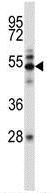 Anti-TAK1 antibody - N-terminal (ab171757) at 1/100 dilution + MCF7 cell line lysates at 35 µg