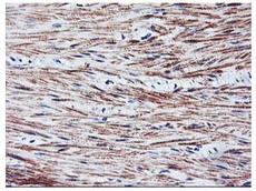 ab119754, at 1/150 dilution, staining Tal1 in formalin-fixed, paraffin-embedded Human colon tissue by Immunohistochemistry.