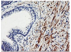 ab119754, at 1/150 dilution, staining Tal1 in formalin-fixed, paraffin-embedded Human prostate tissue by Immunohistochemistry.