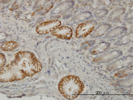 Talin antibody (ab57758) used in immunohistochemistry at 3ug/ml on formalin fixed and paraffin embedded human small Intestine.