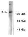 Anti-TAO kinase 2 (phospho S181) antibody (ab32591) at 1/1000 dilution + Rat hippocampal lysates