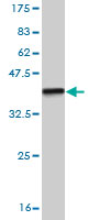 Western blot against tagged recombinant protein immunogen using ab56571 TAO antibody at 1ug/ml.