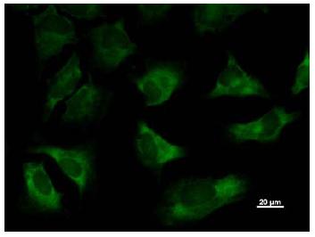 Ab50795, at a dilution of 1/5, staining TARS in HeLa cell by Immunocytochemistry/Immunofluorescence. AlexaFluor®488 Goat anti-mouse IgG was used as the secondary antibody at a dilution of 1/200.