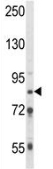Anti-TARSL2 antibody - C-terminal (ab175945) at 1/1000 dilution + 293 cell line lysates at 35 µg