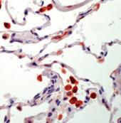 Staining of activated alveolar macrophages in formalin-fixed, paraffin-embedded human lung tissue using ab75452 and an AEC chromogen.