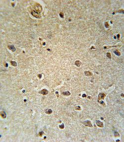 Immunohistochemical analysis of formalin-fixed paraffin-embedded Human brain tissue labeling Slc25a1 using ab174924 at 1/10 dilution followed by peroxidase conjugation of the secondary antibody and DAB staining.