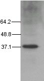 Anti-TATA binding protein TBP antibody [1TBP18] - ChIP Grade (ab818) at 1/2000 dilution + Ros C cells with endogenous TBPPerformed under reducing conditions.