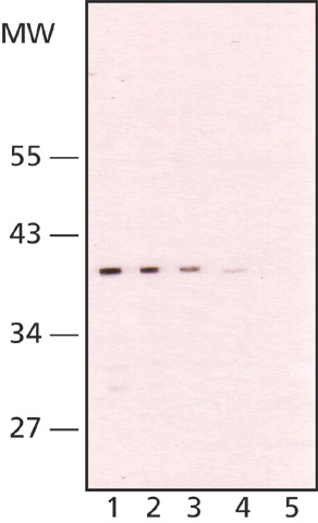 Lane 1 :  Anti-TATA binding protein TBP antibody [58C9] (ab61411) at 2 µg/mlLane 2 :  Anti-TATA binding protein TBP antibody [58C9] (ab61411) at 1 µg/mlLane 3 :  Anti-TATA binding protein TBP antibody [58C9] (ab61411) at 0.5 µg/mlLane 4 :  Anti-TATA binding protein TBP antibody [58C9] (ab61411) at 0.2 µg/mlLane 5 :  Anti-TATA binding protein TBP antibody [58C9] (ab61411) (Negative control )Lane 1 : Nuclear cell extract of D.Mel cells Lane 2 : Nuclear cell extract of D.Mel cells Lane 3 : Nuclear cell extract of D.Mel cells Lane 4 : Nuclear cell extract of D.Mel cells Lane 5 : Nuclear cell extract of D.Mel cells Lysates/proteins at 20 µg/ml per lane.SecondaryGoat Anti-Mouse – Peroxidase conjugate developed using the ECL technique