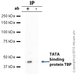 TBP was immunoprecipitated using 0.5mg Hela whole cell extract, 10µg of Mouse monoclonal to TBP and 50µl of protein G magnetic beads (+). No antibody was added to the control (-). The antibody was incubated under agitation with Protein G beads for 10min, Hela whole cell extract lysate diluted in RIPA buffer was added to each sample and incubated for a further 10min under agitation.Proteins were eluted by addition of 40µl SDS loading buffer and incubated for 10min at 70oC; 10µl of each sample was separated on a SDS PAGE gel, transferred to a nitrocellulose membrane, blocked with 5% BSA and probed with ab51841.Secondary: Goat polyclonal to mouse IgG light chain specific (HRP) at 1/20,000 dilution.Band: 40kDa: TATA binding protein TBP.