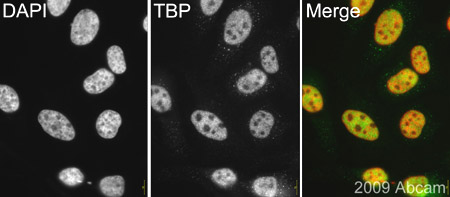 ab63766 (1/500) staining TATA binding protein (TBP) in HeLa cells (green). Cells were fixed with paraformaldehyde, permeabilised with 0.5% Triton X100/PBS and counterstained with DAPI (red) in order to highlight the nucleus. Please refer to abreview for further experimental details.See Abreview