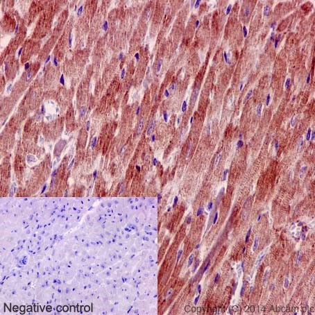 Immunohistochemical analysis of paraffin-embedded Mouse cardiac muscle tissue labeling SLC25A12 with ab192244 at 1/300 dilution (1μg/ml), followed by prediluted HRP Polymer for Rabbit/Mouse IgG. Counter stained with Hematoxylin.