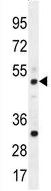 Anti-TBC1D13 antibody (ab170529) at 1/100 dilution + Mouse spleen tissue lysate at 35 µgdeveloped using the ECL technique