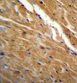 Immunohistochemical analysis of formalin-fixed, paraffin-embedded Mouse heart tissue labeling TBC1D13 with ab170529 at 1/50 dilution followed by peroxidase-conjugated secondary antibody and DAB staining.