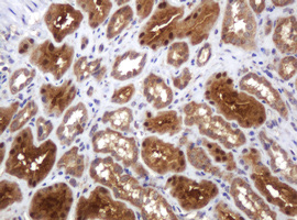 Immunohistochemical analysis of paraffin-embedded Human kidney tissue, labelling TBC1D13 with ab140522 at 1/150 dilution.