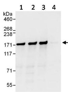 Lane 1: Immunoprecipitation from HeLa whole cell lysate (1 mg for IP, 20% of IP loaded), using an antibody which recognized another epitope of TBC1D4. Lane 2: Detection of Human TBC1D4 by Immunoprecipitation from HeLa whole cell lysate (1 mg for IP, 20% of IP loaded), using ab134744 at 6 µg/mg lysate for IP. Lane 3: Immunoprecipitation from HeLa whole cell lysate (1 mg for IP, 20% of IP loaded), using an antibody which recognized another epitope of TBC1D4. Lane 4: Immunoprecipitation from HeLa whole cell lysate (1 mg for IP, 20% of IP loaded), using Control IgG. Subsequent Western blot detection used ab134744 at 1 µg/ml. Western Blot Gel 4-8% Developed using the ECL technique with an exposure time of 10 seconds.