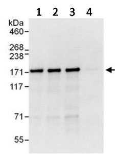 Lane 1: Immunoprecipitation from HeLa whole cell lysate (1 mg for IP, 20% of IP loaded), using an antibody which recognized an upstream epitope of TBC1D4. Lane 2: Immunoprecipitation from HeLa whole cell lysate (1 mg for IP, 20% of IP loaded), using an antibody which recognized an upstream epitope of TBC1D4. Lane 3: Detection of Human TBC1D4 by Immunoprecipitation from HeLa whole cell lysate (1 mg for IP, 20% of IP loaded), using ab134749 at 6 µg/mg lysate for IP. Lane 4: Immunoprecipitation from HeLa whole cell lysate (1 mg for IP, 20% of IP loaded), using Control IgG. Subsequent Western blot detection used ab134749 at 1 µg/ml. Western Blot Gel 4-8% Developed using the ECL technique with an exposure time of 3 seconds.