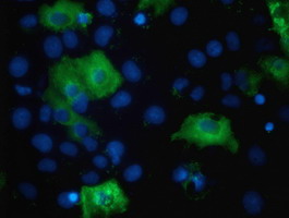 ab119004, at a 1/100 dilution, staining TBC1D4 in COS7 cells transiently transfected with pCMV6-ENTRY TBC1D4, by Immunofluorescence.