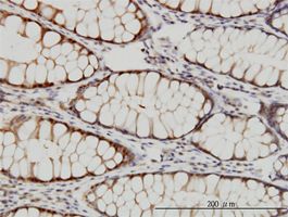 Tbp7 antibody (ab58107) used in immunohistochemistry at 3ug/ml on formalin fixed and paraffin embedded human colon.