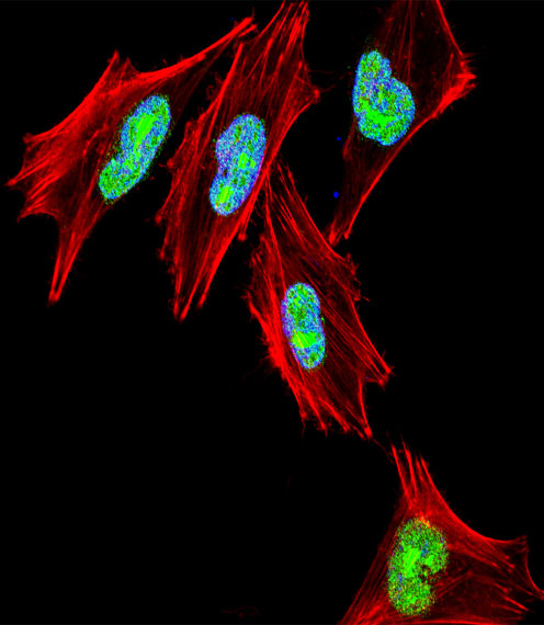Immunofluorescence of A2058 cells labelling TBX1 with ab103127. A2058 cells were fixed with 4% PFA (20 min), permeabilized with Triton X-100 (0.1%, 10 min), then incubated with ab103127 (1:25, 1 h at 37℃). Alexa Fluor® 488 conjugated donkey anti-rabbit antibody (green) was used as the secondary antibody (1:400, 50 min at 37℃). Cytoplasmic actin was counterstained with Alexa Fluor® 555 (red) conjugated Phalloidin (7units/ml, 1 h at 37℃) and nuclei were counterstained with DAPI (blue) (10 µg/ml, 10 min). TBX1 immunoreactivity is localized to the nucleus.