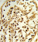 Formalin-fixed and paraffin-embedded Human testis tissue, which was peroxidase-conjugated to the secondary antibody, followed by DAB staining, using ab103127 at a dilution of 1/50.