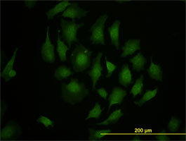 Ab58264 (10 ug/ml) staining of TBX3 in HeLa cells by immunofluorescence.